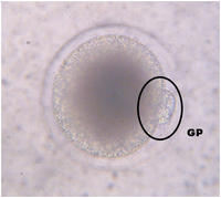 Ovocyte mature présentant un globule polaire (GP). © B. Beneult